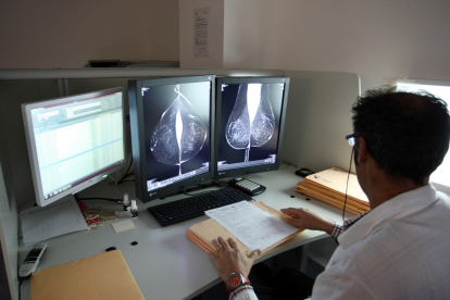 Estudio una mamografía digital en el servicio de mamografías del Hospital Río Hortega de Valladolid. - ICAL