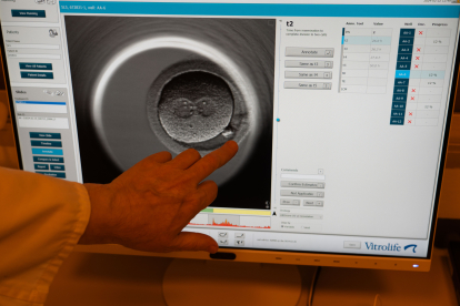 Un embrión en la Unidad de Reproducción Asistida del Hospital Clínico de Valladolid - ICAL