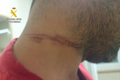 Heridas ocasionadas al motorista en Anaya de Alba