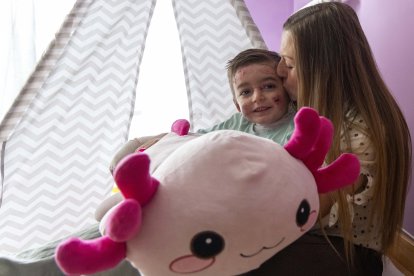 El pequeño Javi Gallo, de seis años, convive desde su nacimiento con la enfermedad conocida como piel de mariposa.
