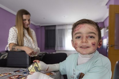 El pequeño Javi Gallo, de seis años, convive desde su nacimiento con la enfermedad conocida como piel de mariposa.
