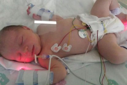 Jimena, recién nacida antes de ser traslada a Glasgow (Escocia) en ambulancia.