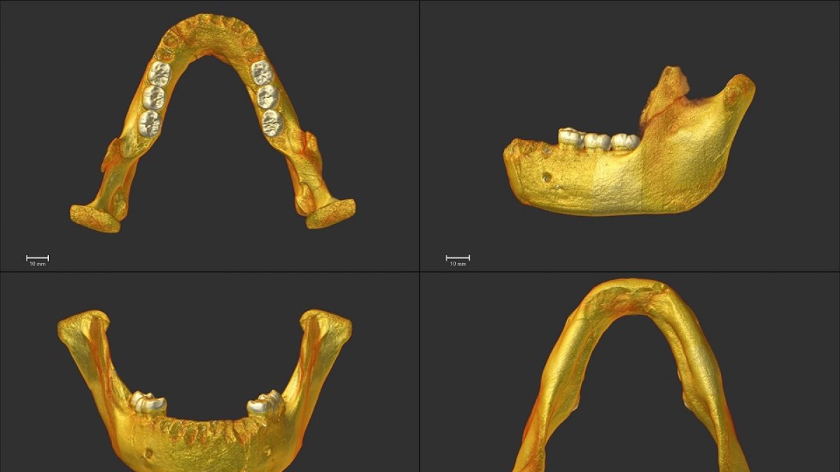 El Cenieh realiza el análisis morfológico y métrico de los molares inferiores de la mandíbula de Montmaurin-La Niche (Francia) mediante microtomografía computarizada para estudiar el origen de los neandertales. - ICAL