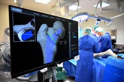 El hospital vallisoletano es el primero público en España en contar con una plataforma robótica para planificar operaciones protésicas en 3D