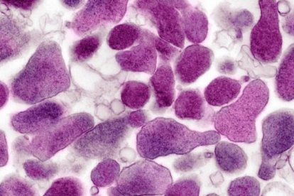 Mycoplasma genitalium, bajo el lente de un microscopio