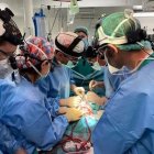 Una bebé de 13 meses de Segovia, primer caso en el mundo de trasplante de intestino tras donación en asistolia. Ical