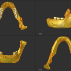 El Cenieh realiza el análisis morfológico y métrico de los molares inferiores de la mandíbula de Montmaurin-La Niche (Francia) mediante microtomografía computarizada para estudiar el origen de los neandertales. - ICAL