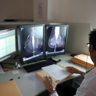 Estudio una mamografía digital en el servicio de mamografías del Hospital Río Hortega de Valladolid. - ICAL