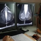 Estudio una mamografía digital , en el servicio de mamografías del Hospital Río Hortega de Valladolid