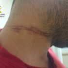 Heridas ocasionadas al motorista en Anaya de Alba