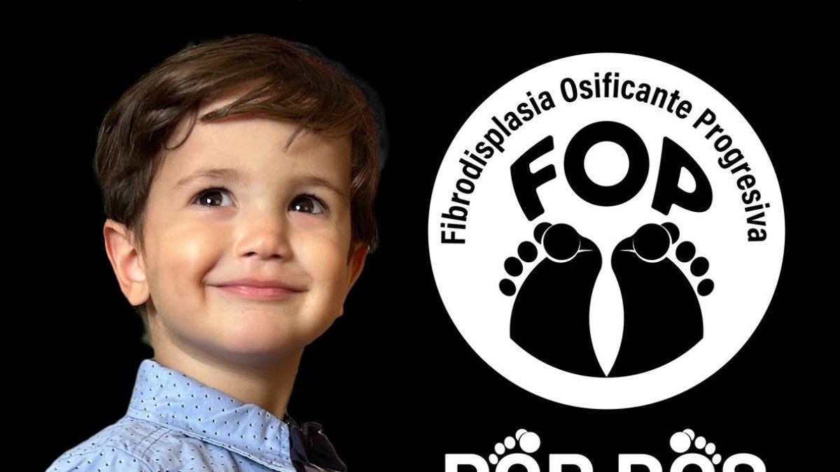El pequeño Darío, afectado por fibrodisplasia osificante progresiva.