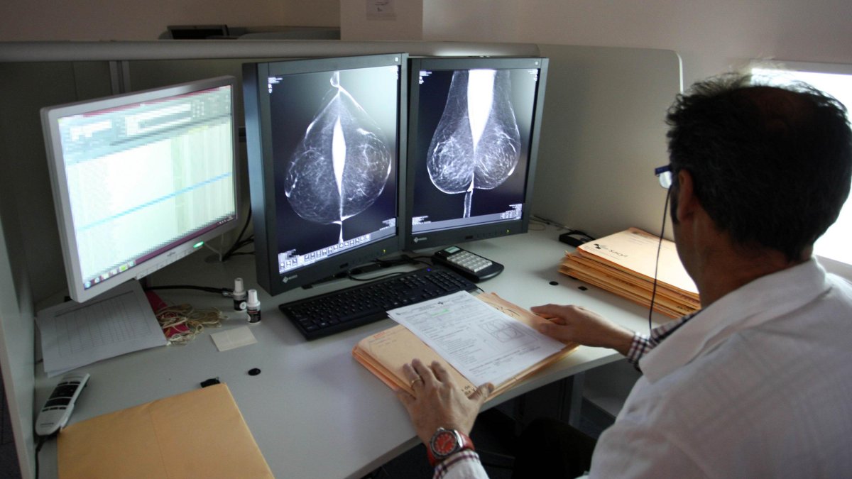 Un radiólogo observa las imágenes tomadas por el mamógrafo en el Hospital Río Hortega de Valladolid.