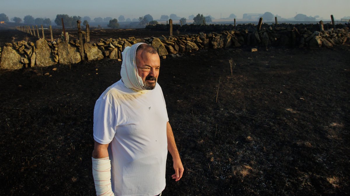 José Manuel Blanco, con quemaduras en varias partes del cuerpo, observa la zona arrasada el incendio forestal de Ciperez (Salamanca)