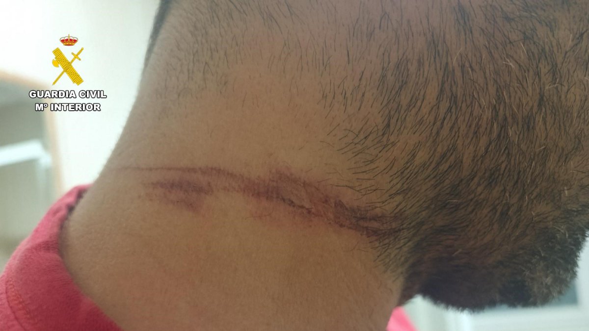 Heridas ocasionadas al motorista en Anaya de Alba