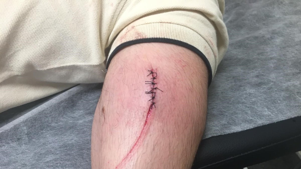 Lesiones de un funcionario por corte tras la agresión de un interno.
