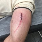 Lesiones de un funcionario por corte tras la agresión de un interno.